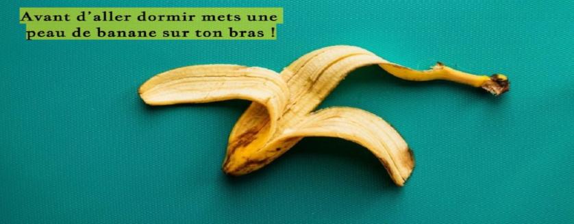 Avant d’aller dormir mets une peau de banane sur ton bras !