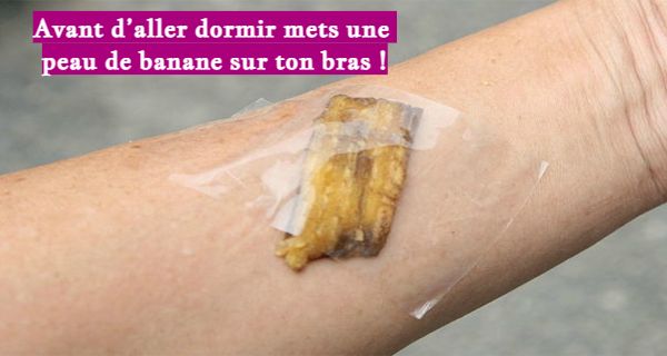 Avant d’aller dormir mets une peau de banane sur ton bras !