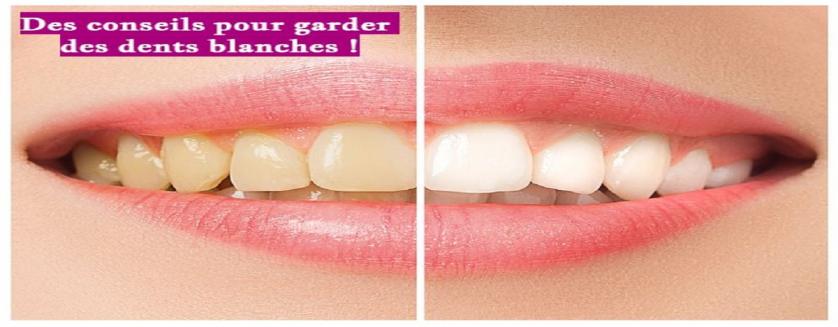 Des conseils pour garder des dents blanches !