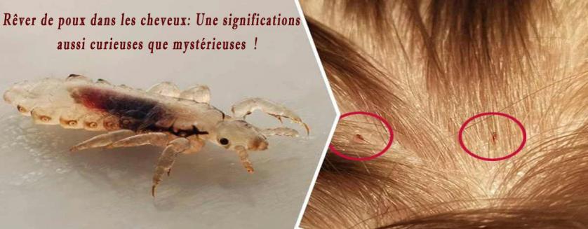 Rêver de poux dans les cheveux: Une significations aussi curieuses que mystérieuses !