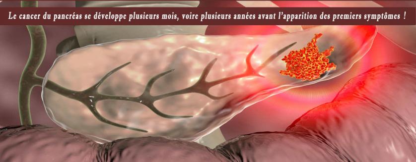 Le cancer du pancréas se développe plusieurs mois, voire plusieurs années avant l’apparition des premiers symptômes !