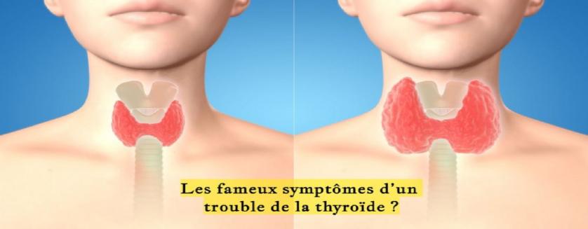 Les fameux symptômes d’un trouble de la thyroïde ?