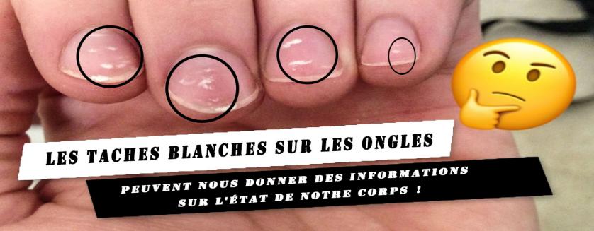 Les taches blanches sur les ongles peuvent nous donner des informations sur l'état de notre corps !