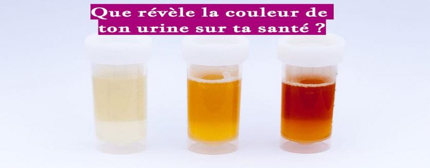 Que révèle la couleur de ton urine sur ta santé ?