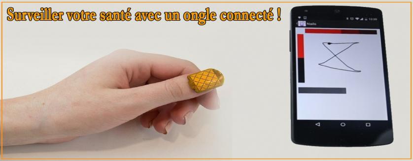 Surveiller votre santé avec un ongle connecté !