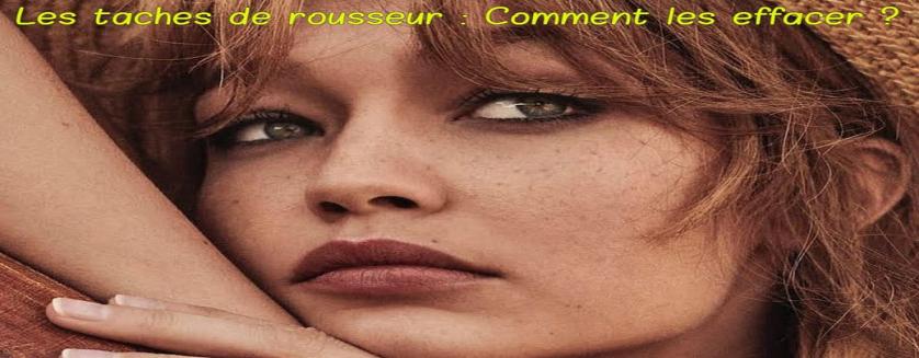 Les taches de rousseur : Comment les effacer ?